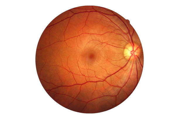 netvliesaandoeningen oogarts behandeling